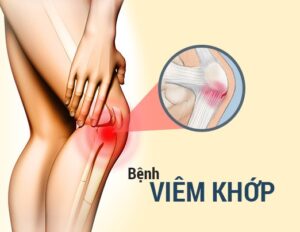Bệnh xương khớp 