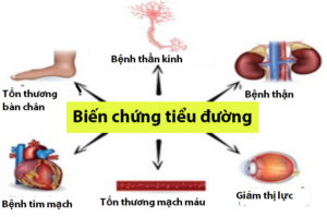 BIEN CHUNG BENH TIEU DUONG