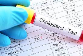 Xét nghiệm cholesterol