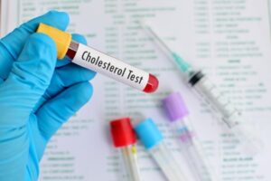chi so mo mau - cholesterol
