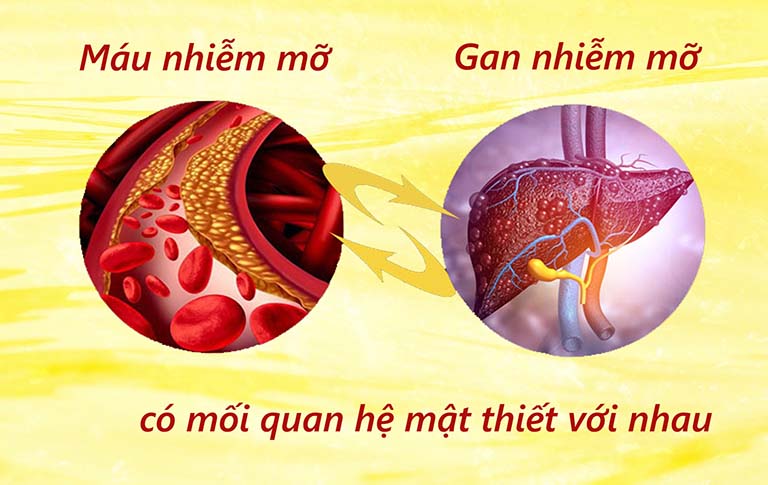máu nhiễm mỡ gan nhiễm mỡ