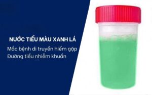 nước tiểu màu xanh