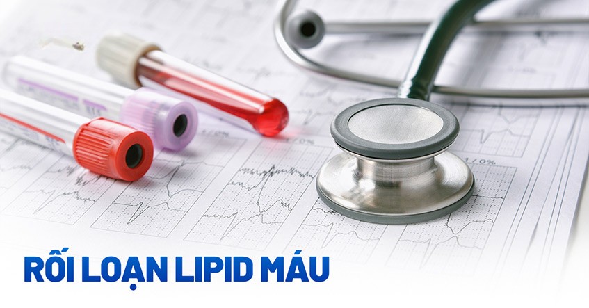 roi-loan-lipid-mau