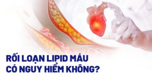 thuốc mỡ máu