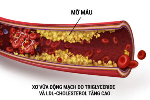 tác hại của triglyceride cao