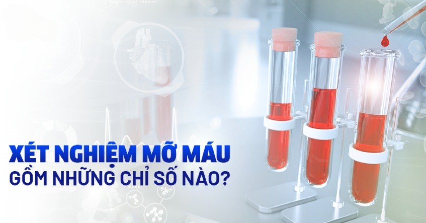 xet-nghiem-chi-so-mo-mau
