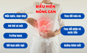 mất ngủ nóng gan - Dr Trang
